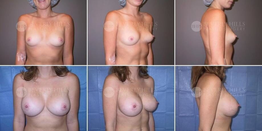 Image of patient post surgery