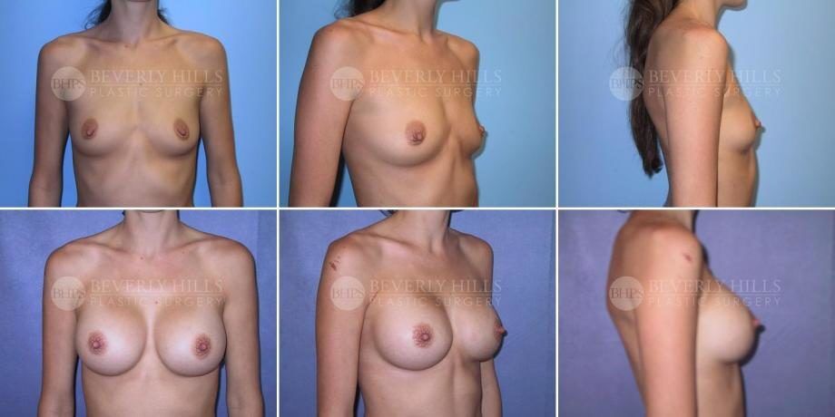 Image of patient post surgery