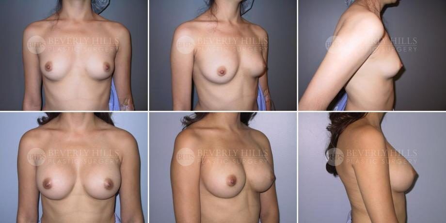 Image of patient post surgery